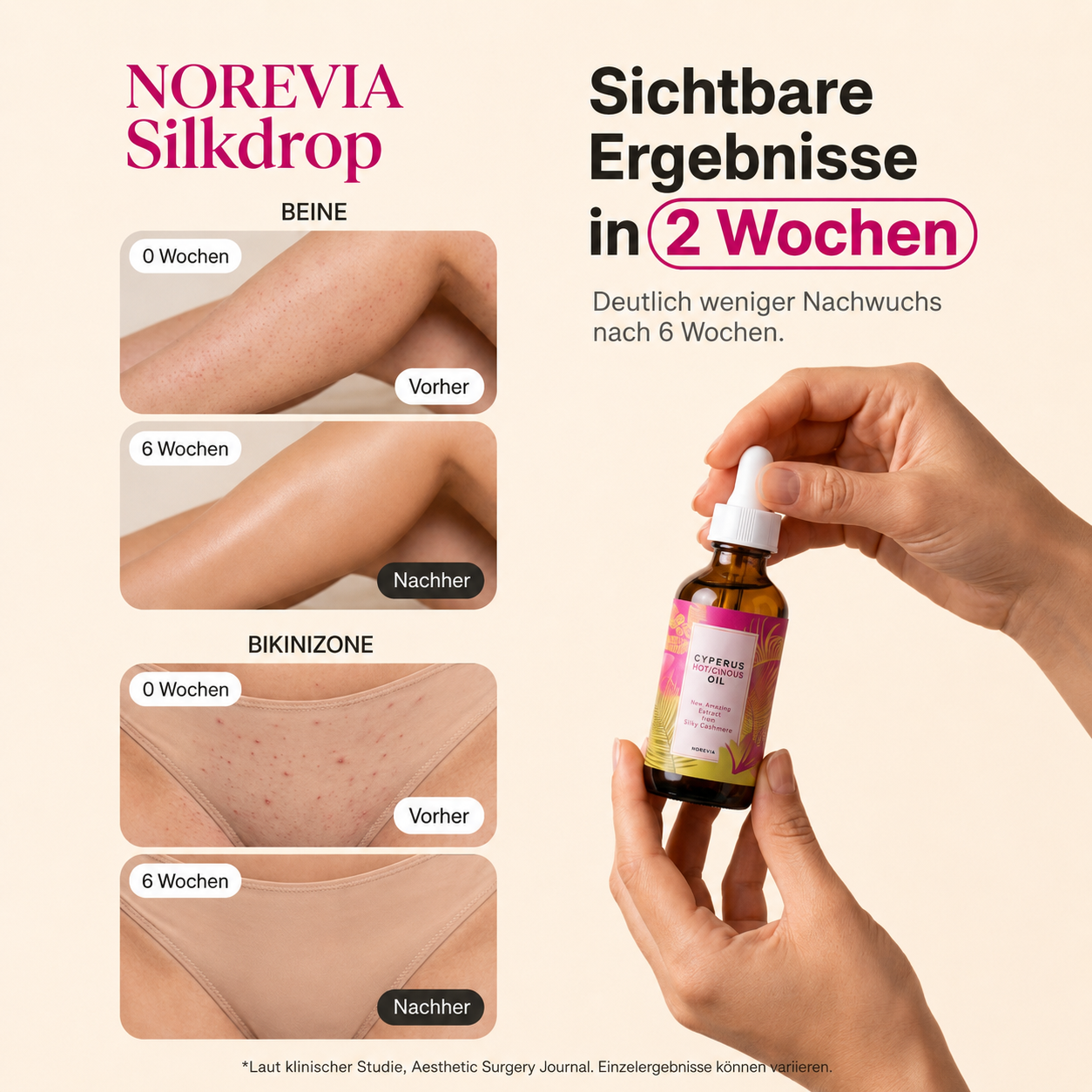NOREVIA Silkdrop I Haarwuchs-Hemmöl